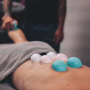 Wellnessterapeut som utför statisk koppning på en klients rygg med Curam silikonkoppar i turkos, ljusrosa och vitt under en professionell kroppskoppningsbehandling.